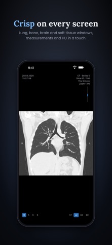 PlexusMD Viewer screenshot 4