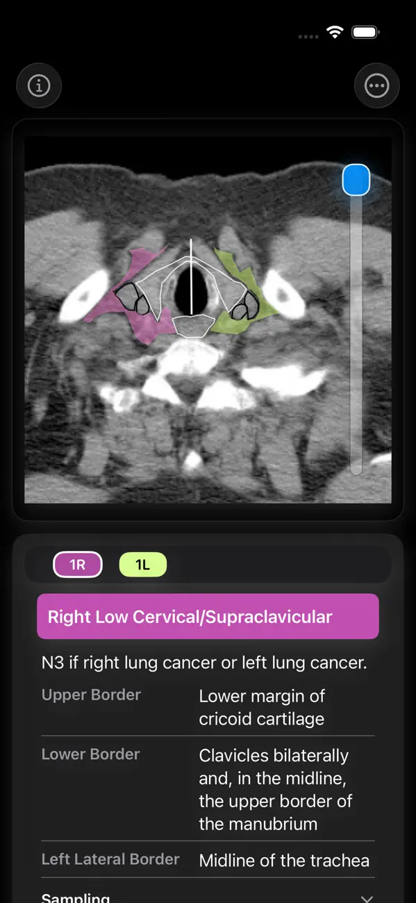 Screenshot #2 pour Thoracic Lymph Node Map