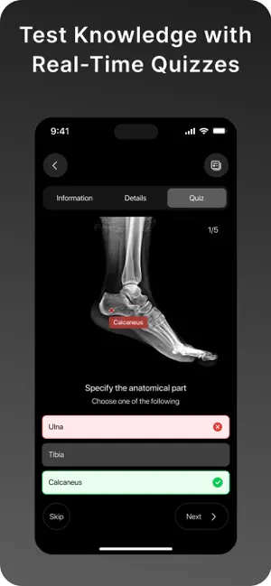 XRay - Sublux Anatomy Learning screenshot 4