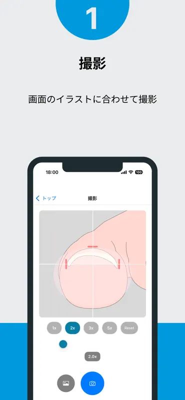 巻き爪チェッカー screenshot 2 of 4