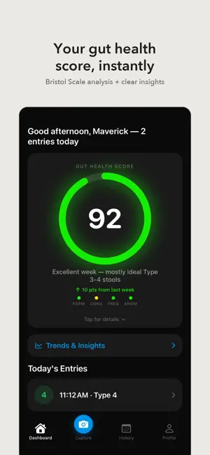 Stooly - AI Poop & Gut Tracker screenshot 1