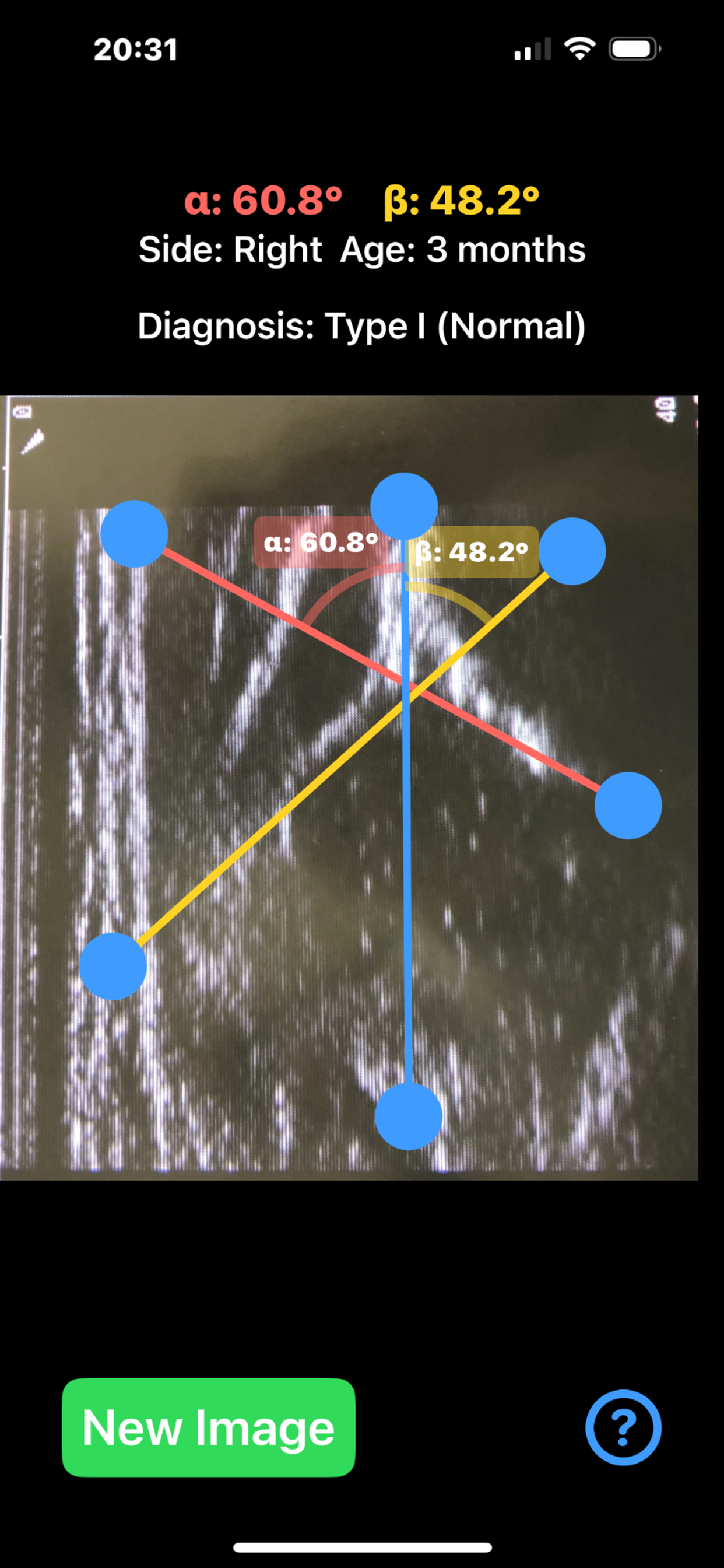 SonoHipAngles screenshot 6