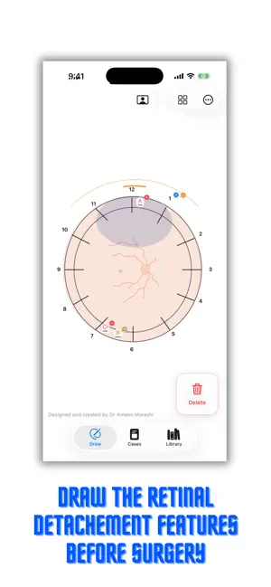 RetinaSketchPro screenshot 1