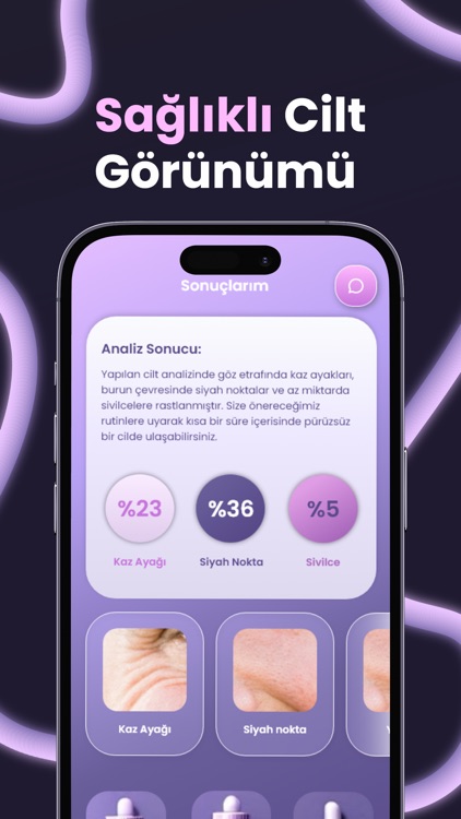 Epiderm AI: Cilt Bakım Analizi