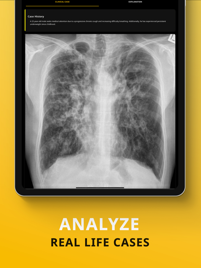 Chest X-ray Academy Learn CXR