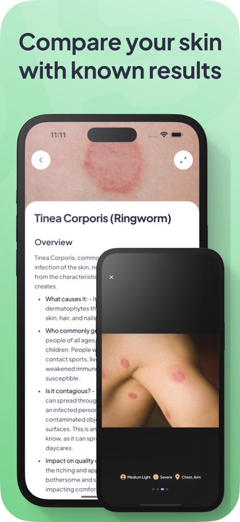 Rash ID: Skin Rash Identifier - Medical App | MWM