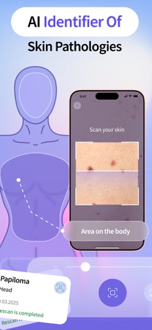 AI Skin Scanner - SkinAI iPhone screenshot