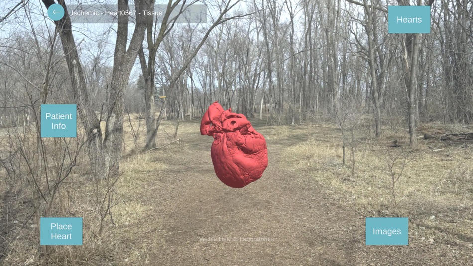 A Heart to Learn (iOS) Podle: Regents of the University of Minnesota A Heart to Learn (iOS) Podle: Regents of the University of Minnesota