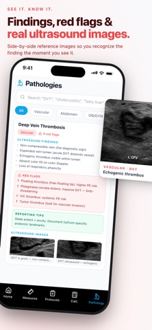 SonoBuddy-Ultrasound Reference Screenshot 5 of 5