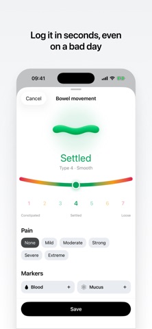 Settle: IBS & Gut Tracker Screenshot 3 of 5