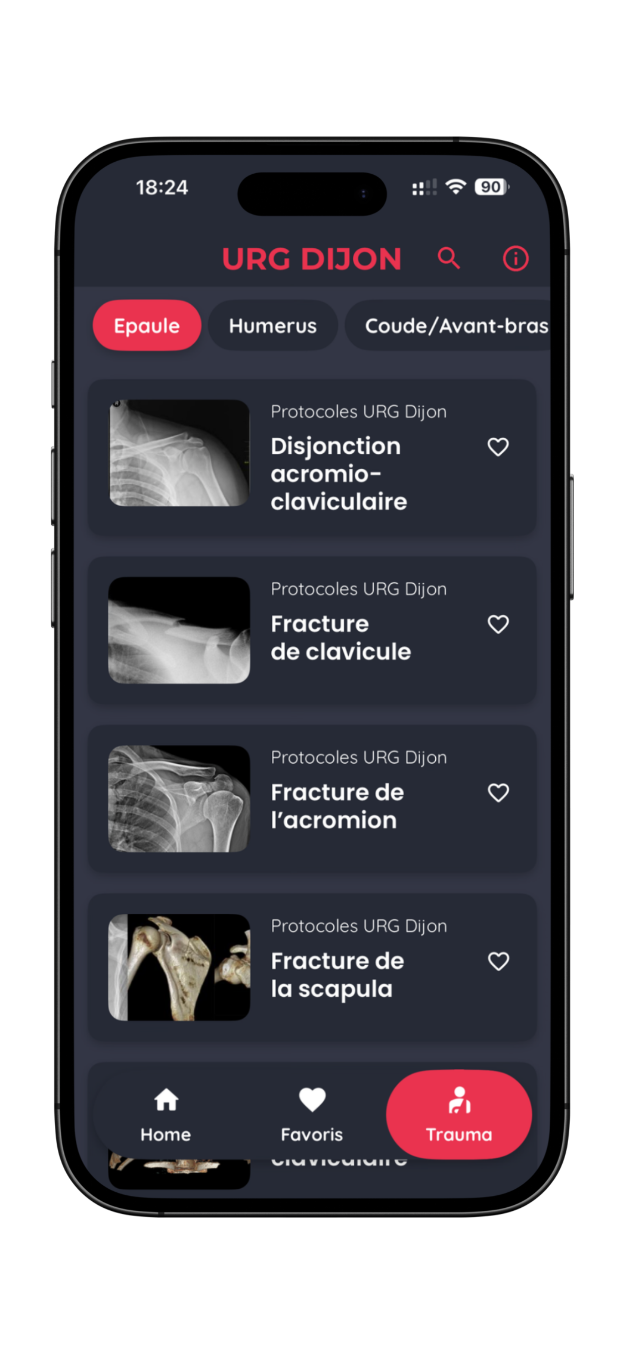URG Dijon screenshot 4