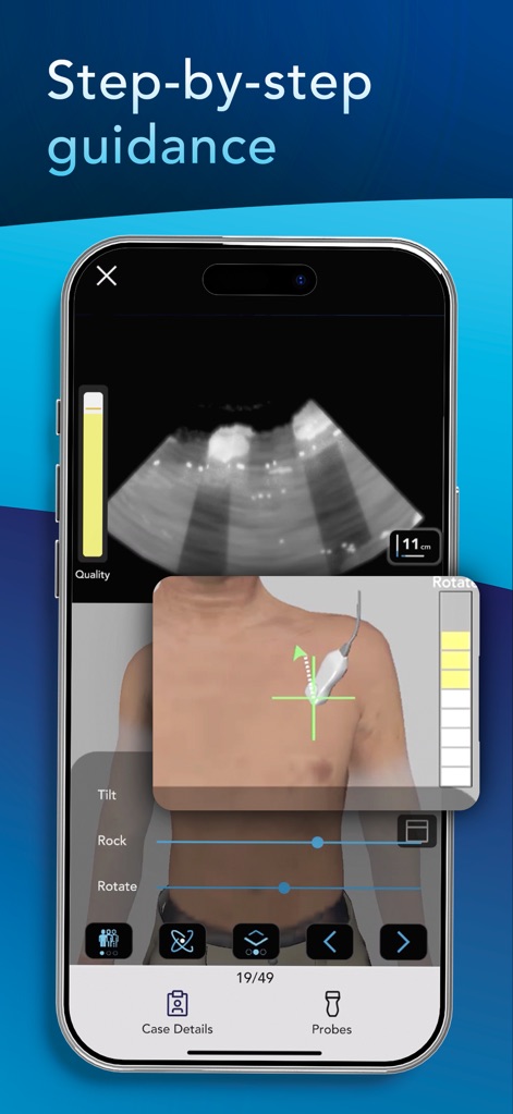 POCUS Simulator - 의료 앱 | MWM