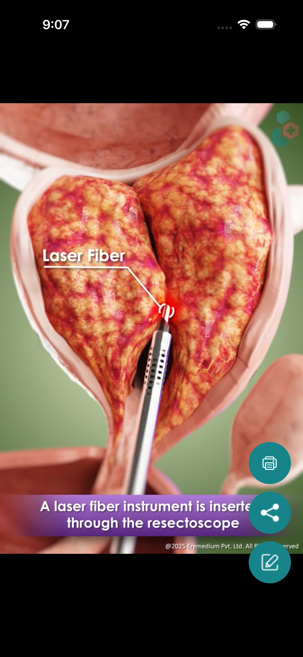 MedXplain-3D Patient Education screenshot 6