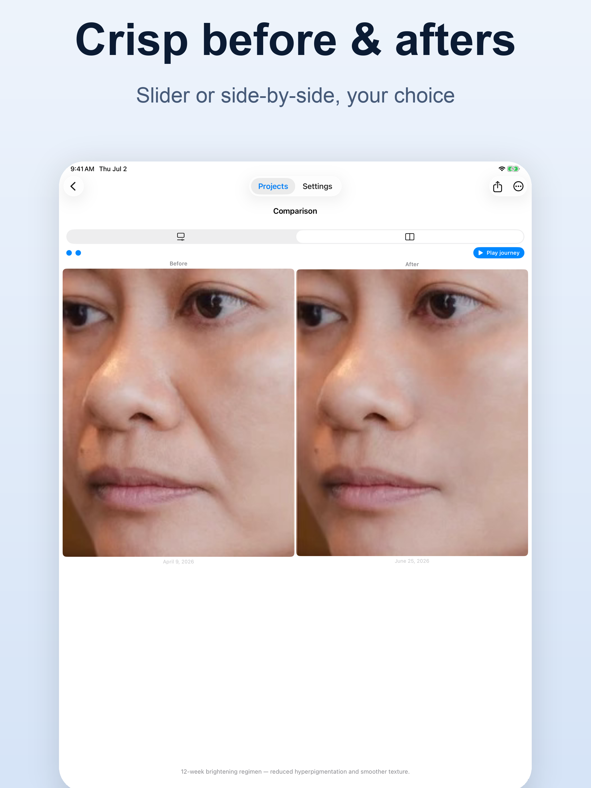 SideLens Before & After Photos screenshot 7