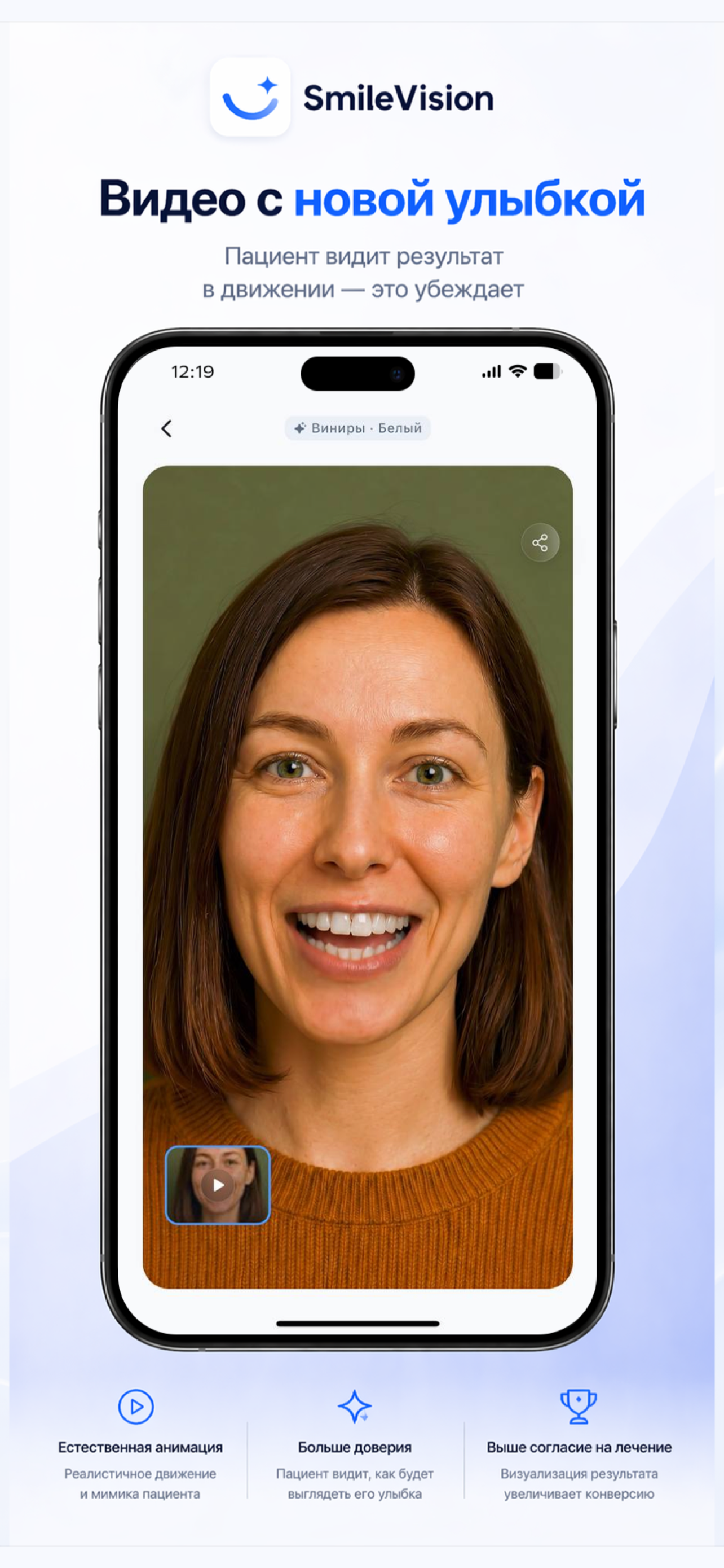 SmileVision