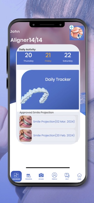Aligner Track Screenshot 7 of 7