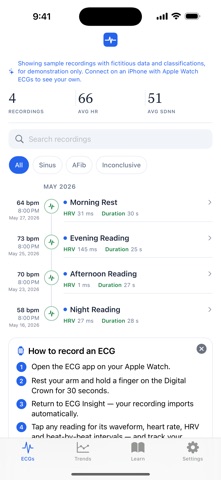ECG Insight — Watch ECG Screenshot 1 of 5