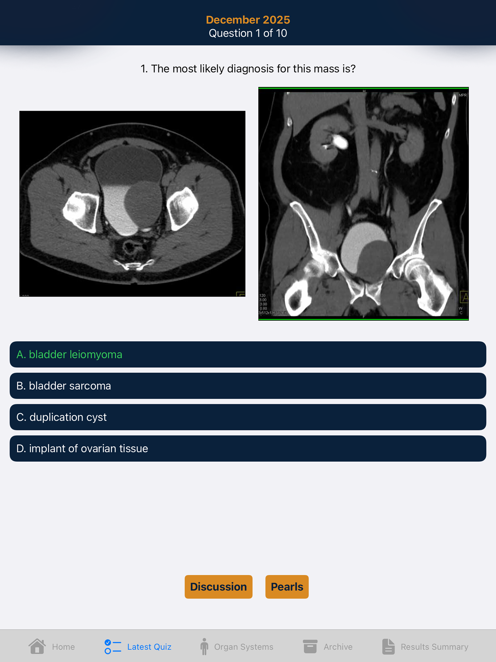 CTisus iQuiz 26