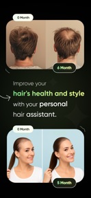 AI Hair Scanner & Health Check screenshot