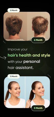 AI Hair Scanner & Health Check iPhone screenshot