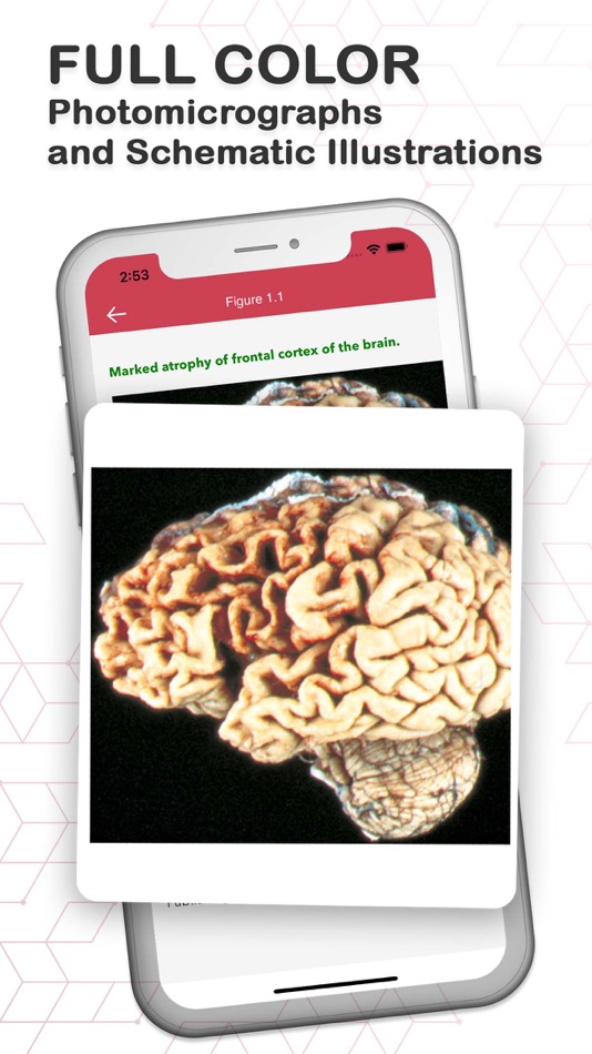 #4. Board Review Series-Pathology (macOS) By: Skyscape Medpresso Inc