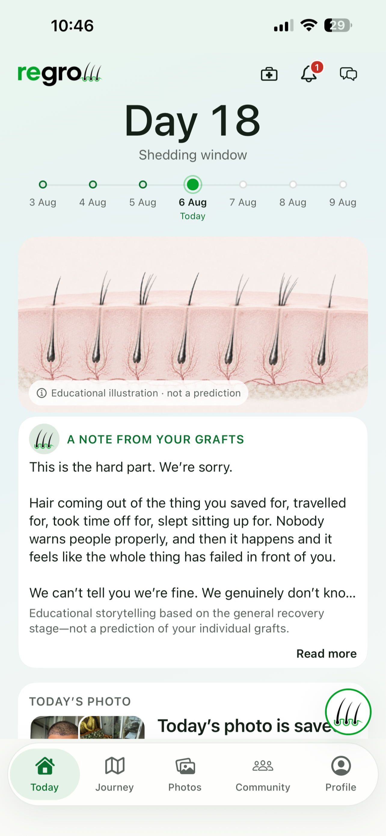 Regrow: Hair Transplant Care screenshot 8
