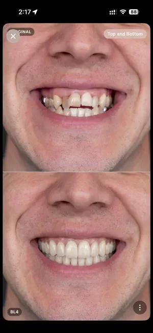 Bleach Dental screenshot 2