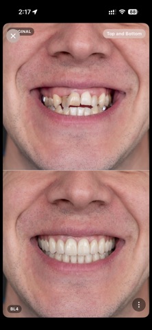 Bleach Dental Screenshot 2 of 10
