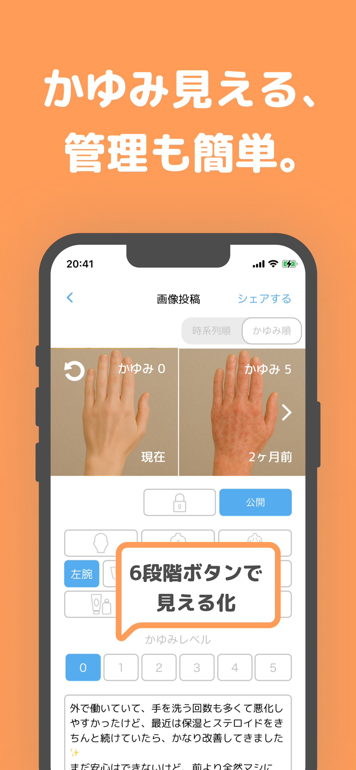 アトピー見える化アプリ-アトピヨ