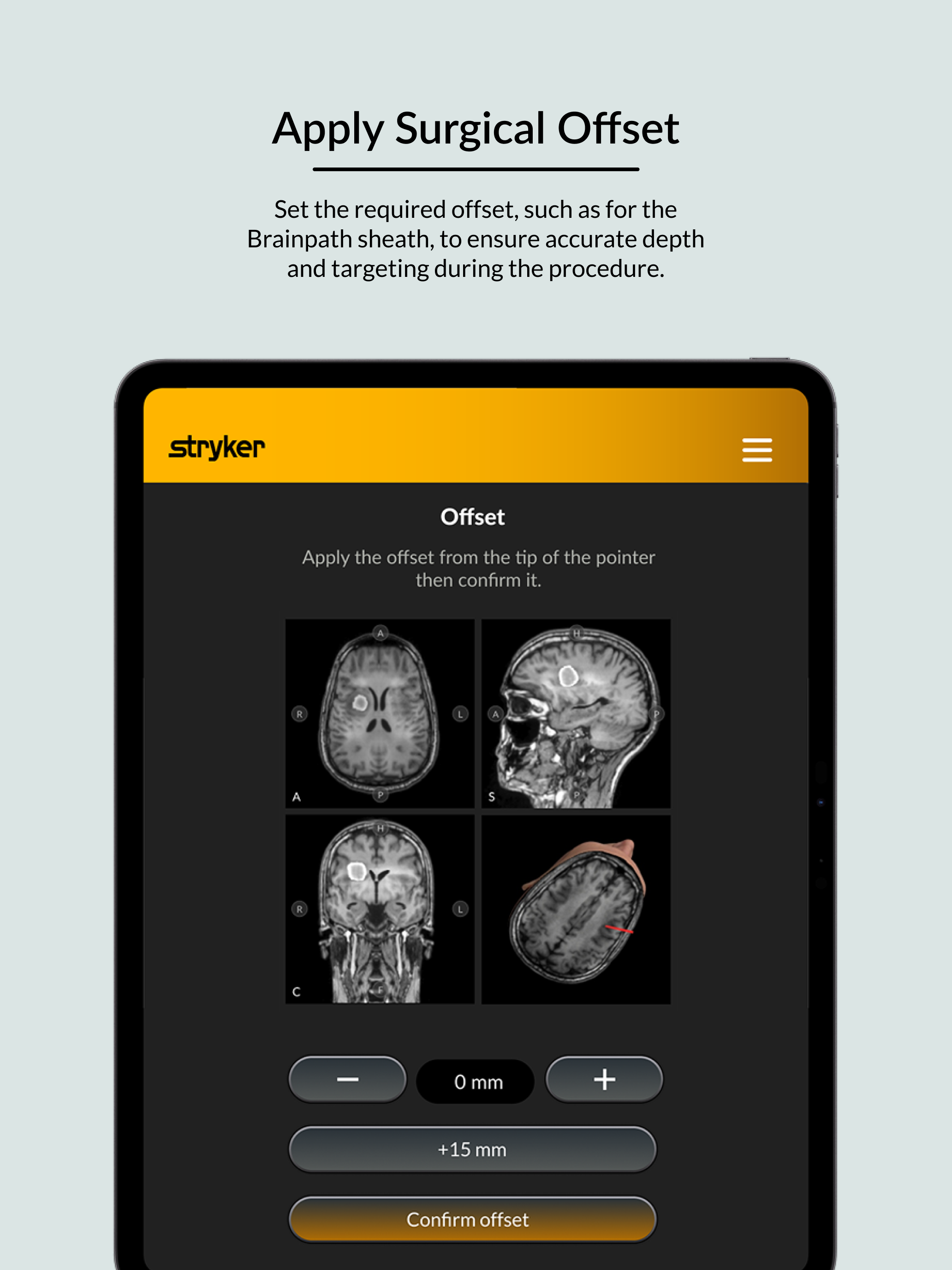 Brain Target Guidance