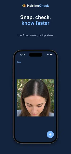 HairlineCheck screenshot 4