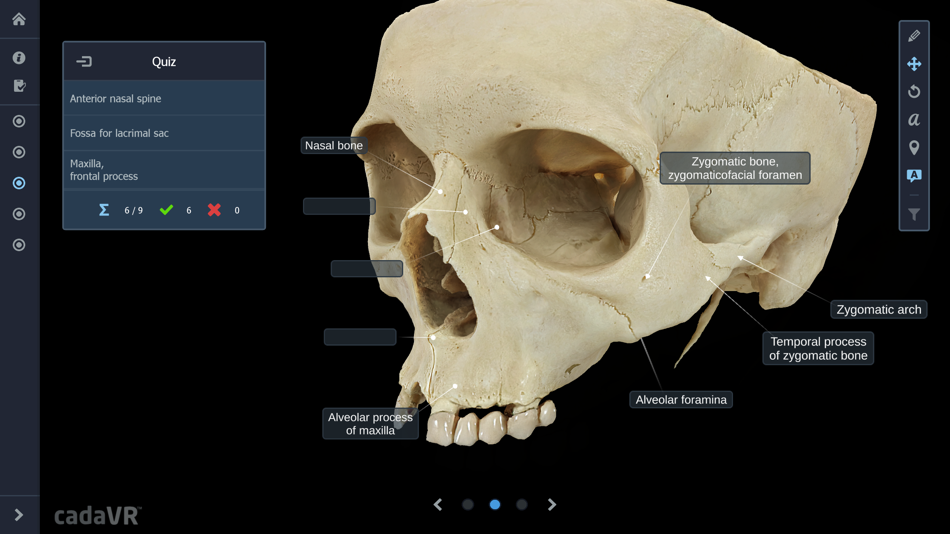 #3. cadaVR anatomy (iOS) By: MOZAIK Education Ltd.