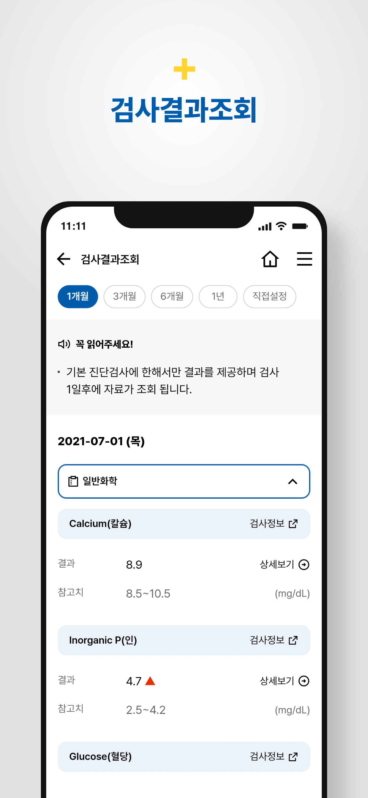 AI Captions: Video Editor