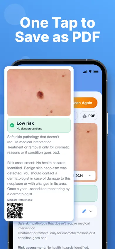AI Skin Scanner: Mole Tracker screenshot 4