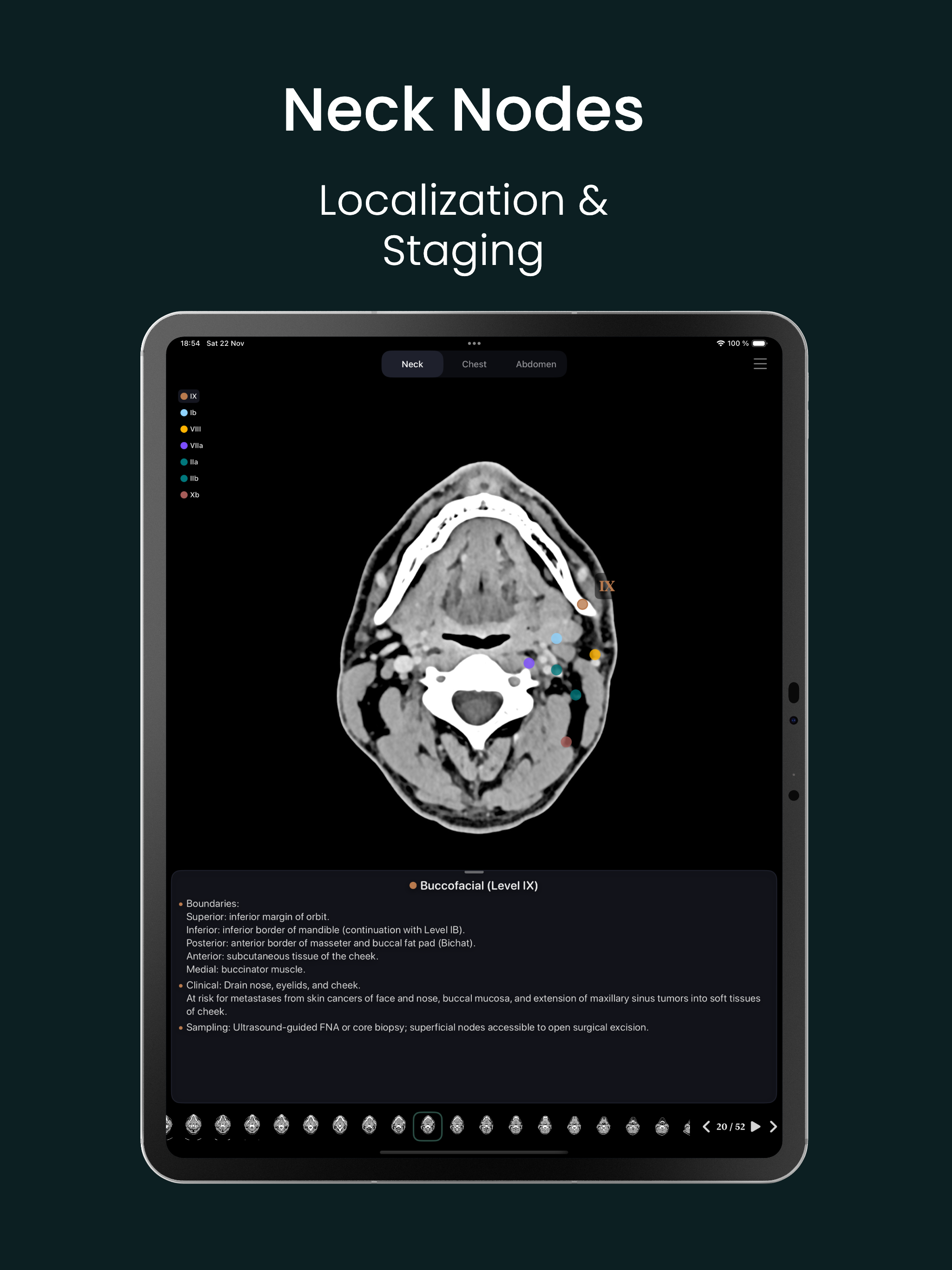 Lymph Atlas