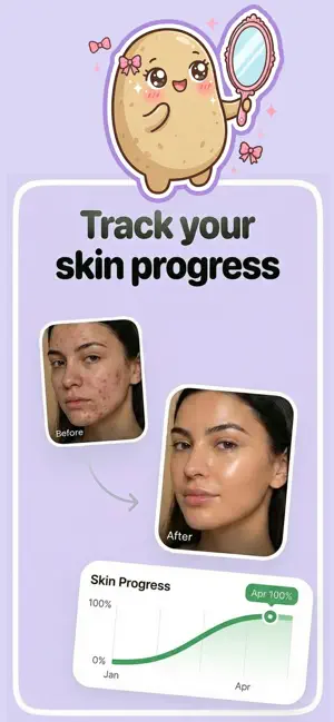 Skineat AI - Acne Food Scanner screenshot 4