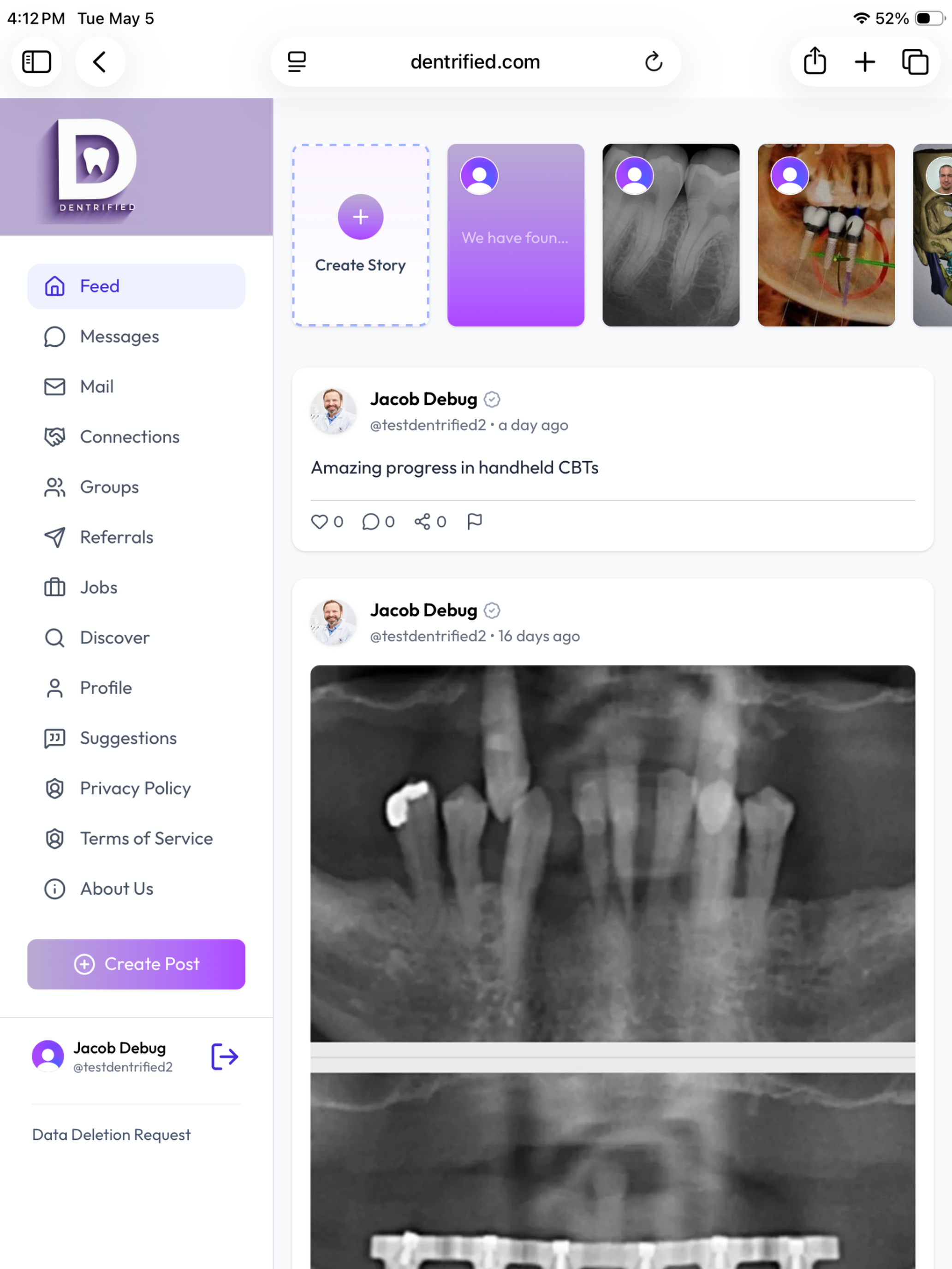 Dentrified