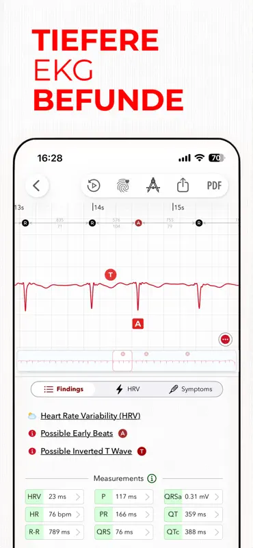 ECG+ | Your Watch ECG Reader screenshot 7 of 10