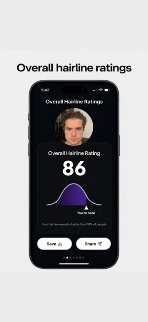 HairMaxx: AI Hairline Analysis screenshot 3