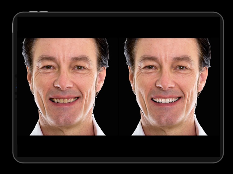 Instant Smiles screenshot-5