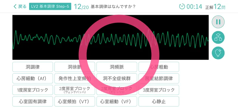 心電図マスターアプリ screenshot 6 of 10
