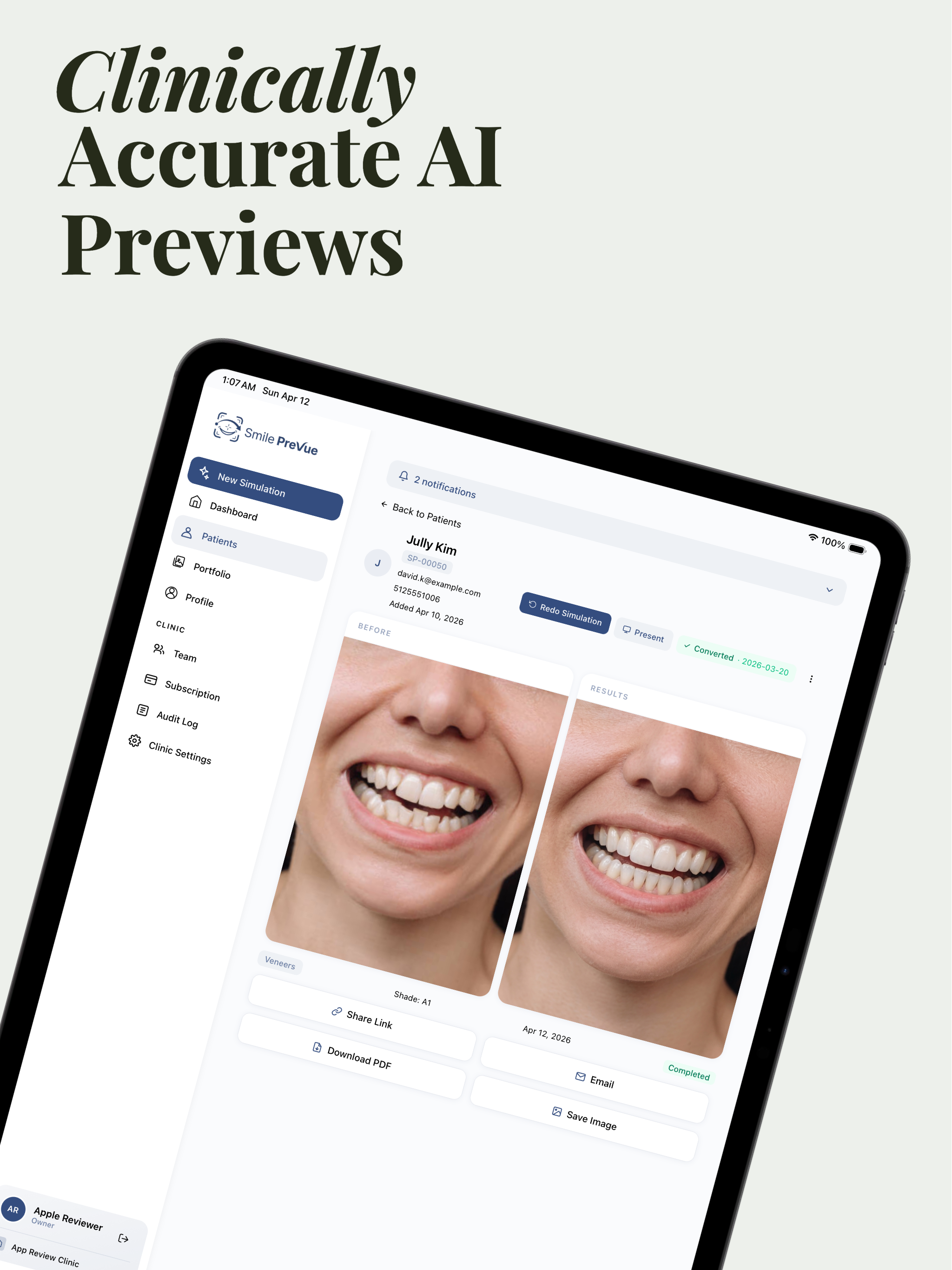 Smile PreVue
