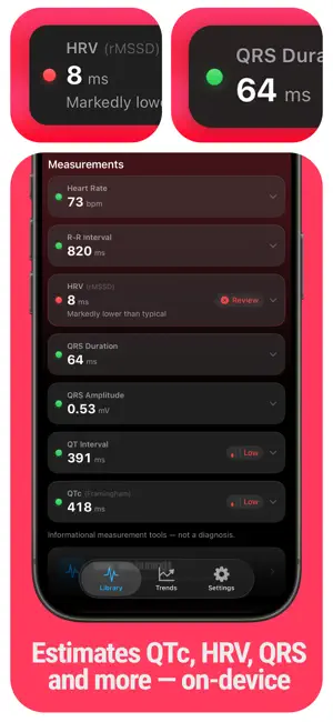 ECG Tracker+ EKG Reader HRV screenshot 3