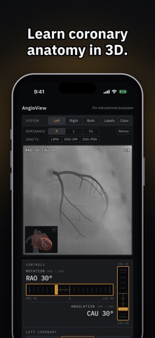 AngioView iPhone screenshot 1