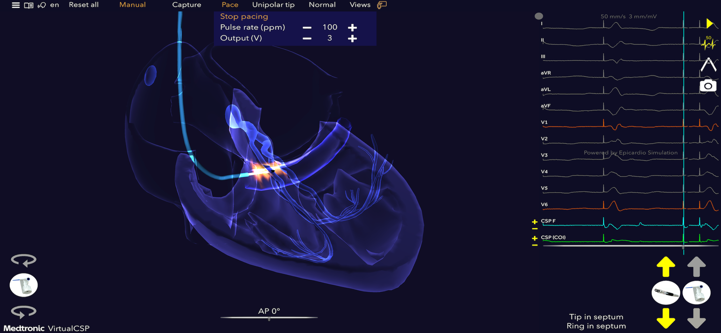 Medtronic VirtualPulse screenshot 5