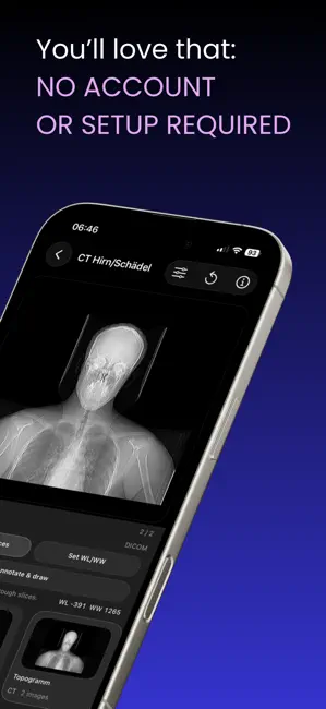 DICOM Viewer : MRI CT XRAY & + iPhone screenshot 5