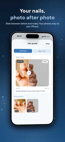 Monyx: Stop Nail Biting Screenshot 9 of 9