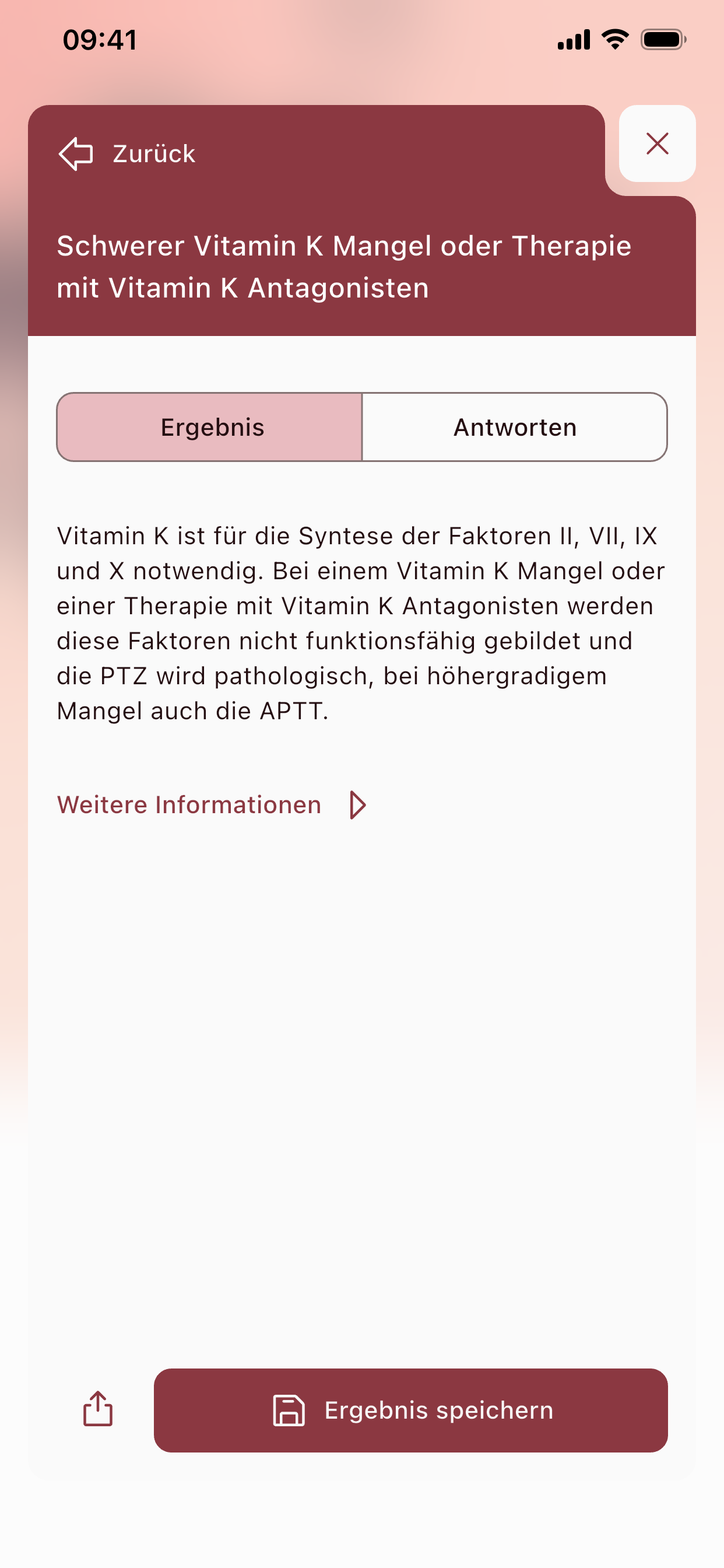 Clotting-Guide
