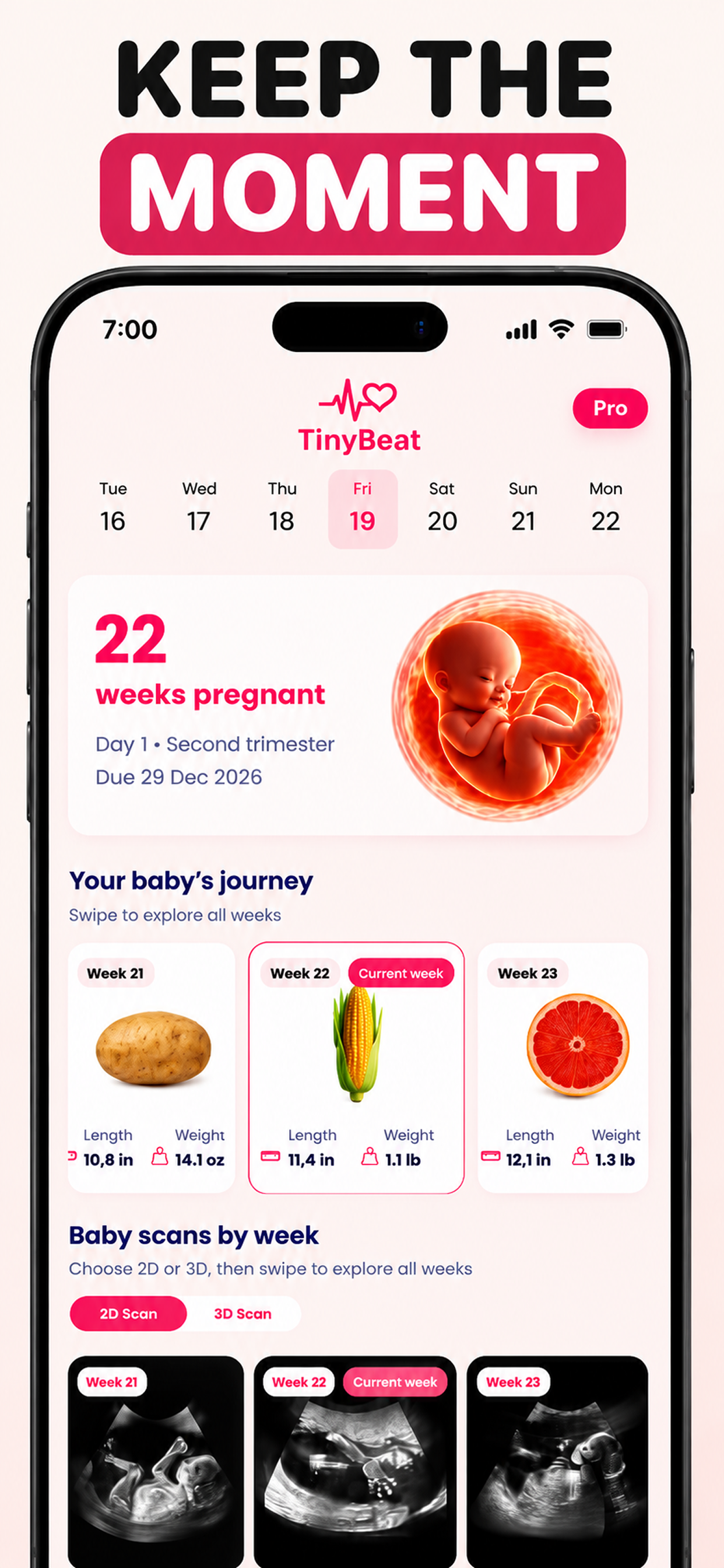TinyBeat: Baby Heartbeat screenshot 5
