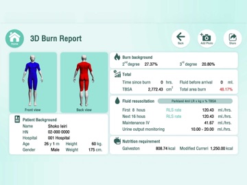 3D Burn iPad screenshot 1